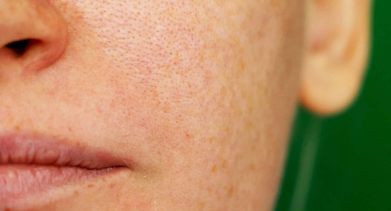 25 Marcas de Cremas para cerrar los poros de la cara